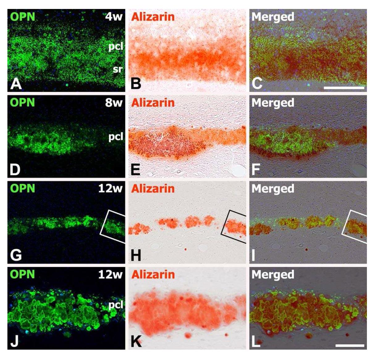 Spatiotemporal relationships of OPN and alizarin red staining in the hippocampal CA1 region at 4 (A– C), 8 (D– F) and 12 weeks (G– L) after transient forebrain ischemia.