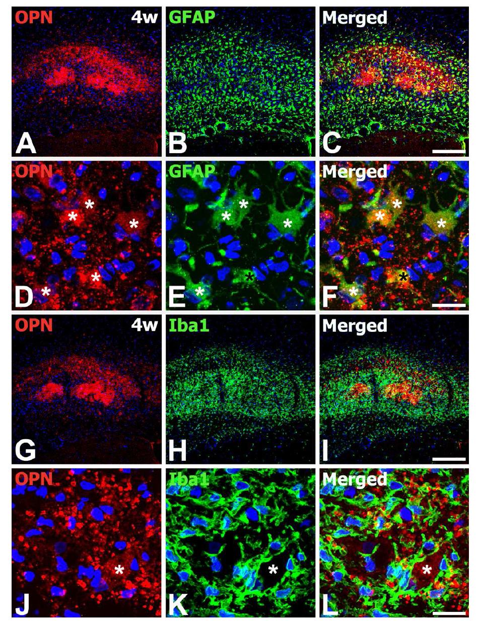 Relationship between OPN protein expression and astroglial (A−F) and microglial (G−L) respon ses in the hippocampal CA1 region 4 weeks after transient forebrain ischemia.