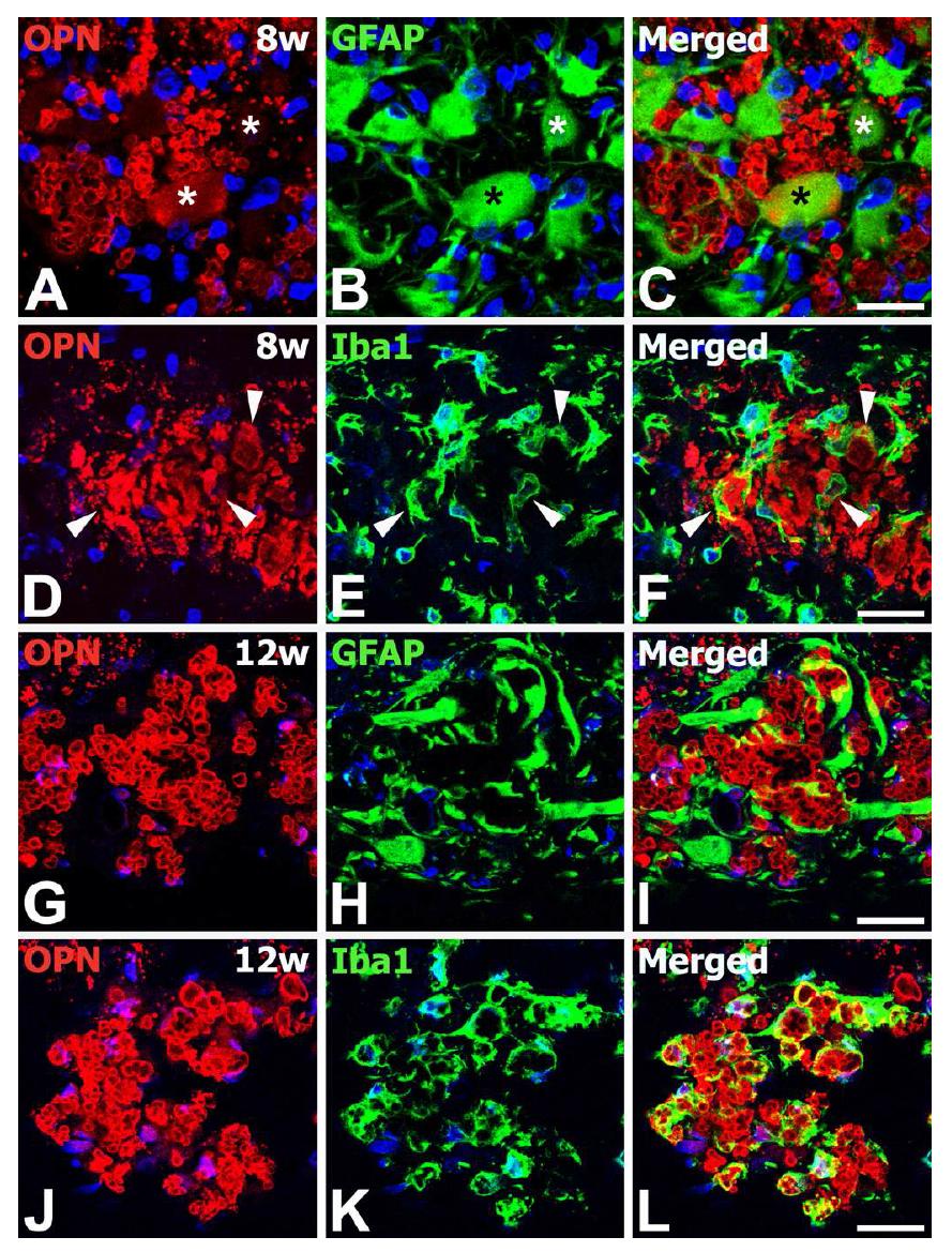 Relationship between OPN protein and astroglial (A−C, G−I) and microglial (D−F, J−L) respo nses in the hippocampal CA1 region 8 (A−F) and 12 weeks (G−L) after transient forebrain ischemia. (A −C) Double labeling for OPN and GFAP showed that while some astrocytes showed tiny granular deposit s of immunostaining (asterisks in A−C), most astrocytes were unlabeled or weakly labeled.