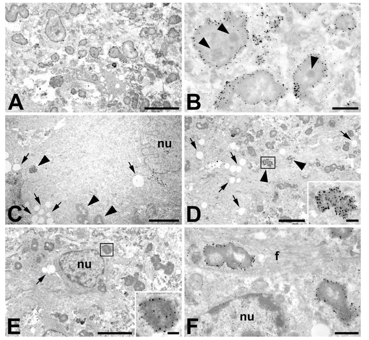 Ultrastructural localization of OPN by the immunogold-silver method in the CA1 region at 4 we eks post ischemia.