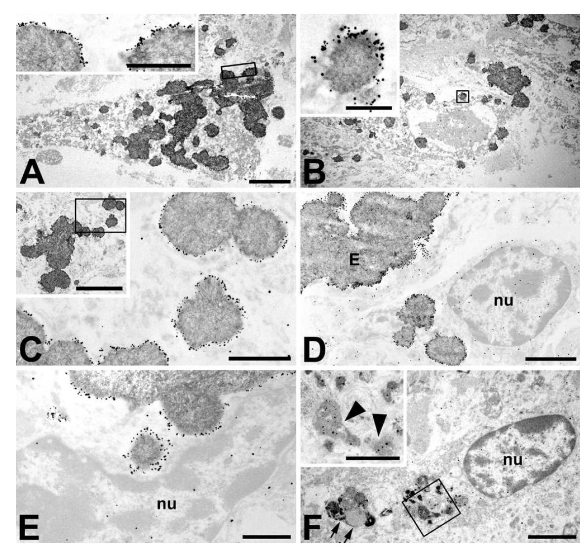 Ultrastructural localization of OPN by the immunogold-silver method in the CA1 region at 8 we eks post ischemia.