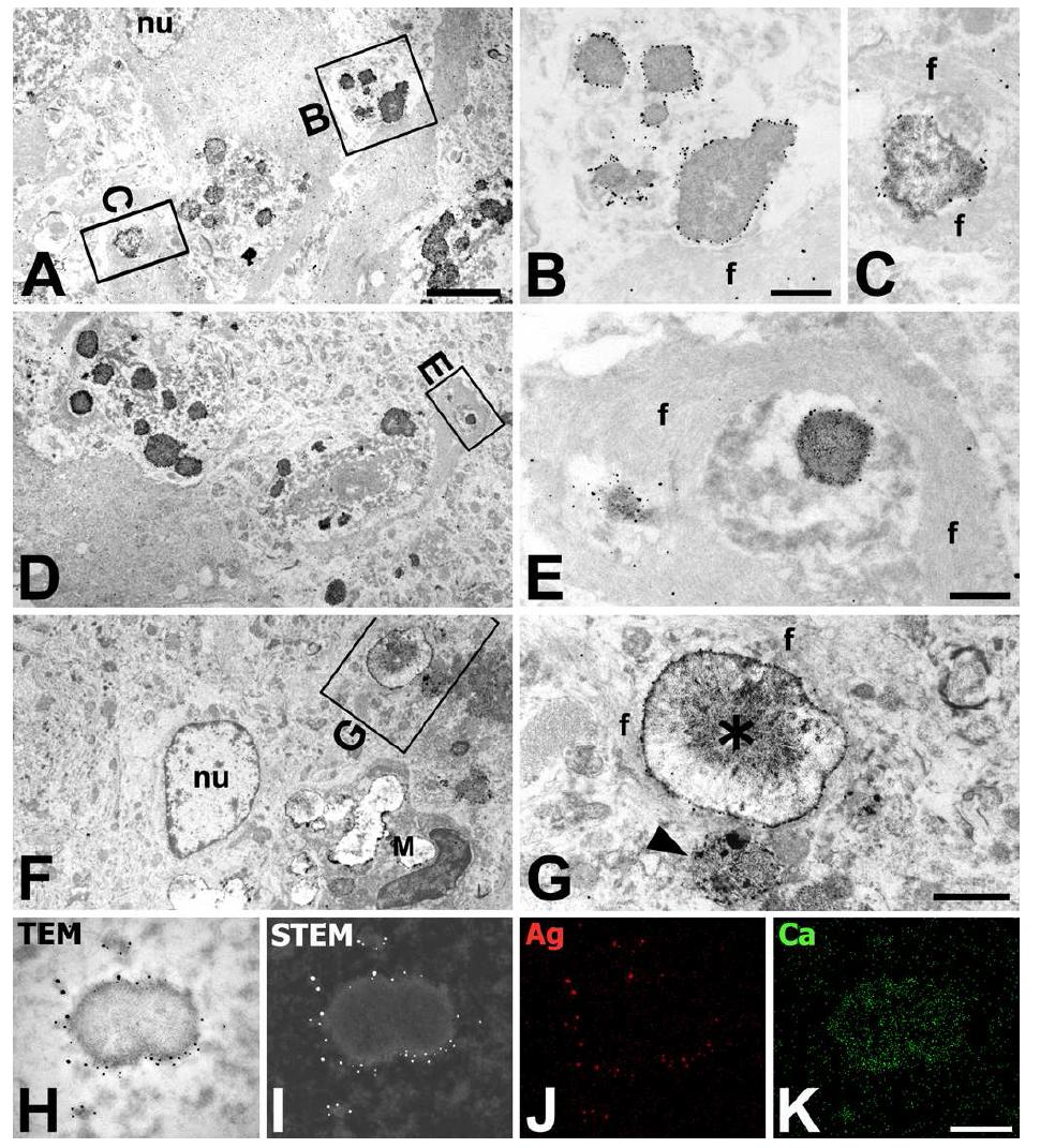 Ultrastructural localization of OPN in association with reactive astrocytes (A−G) and elemental maps of OPN-labeled deposit (H−K) in the CA1 region at 8 weeks post ischemia.