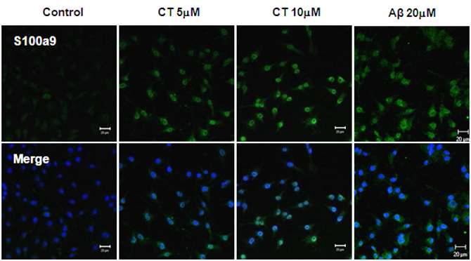 BV2 세포주에서 CT 또는 Aβ 단백질 처리 시 S100a9 단백질의 분포 및 발현양상