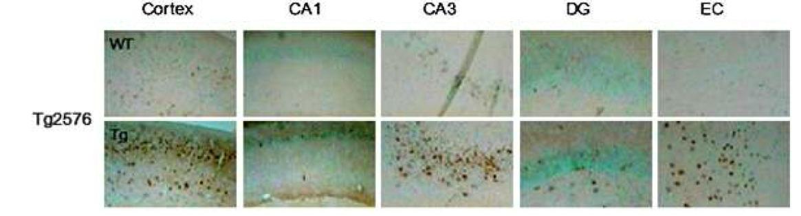 Tg2576 마우스 뇌의 cortex 부위에서 S100a9의 발현 양상