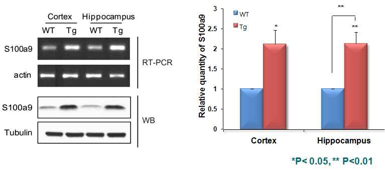 APPV717I-CT100 마우스 뇌의 각 부위에서의 S100a9의 RNA 및 단백질 발현 양상