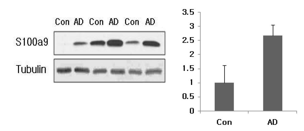 알츠하이머병 환자 뇌의 cortex 부위에서 S100a9의 발현 양상