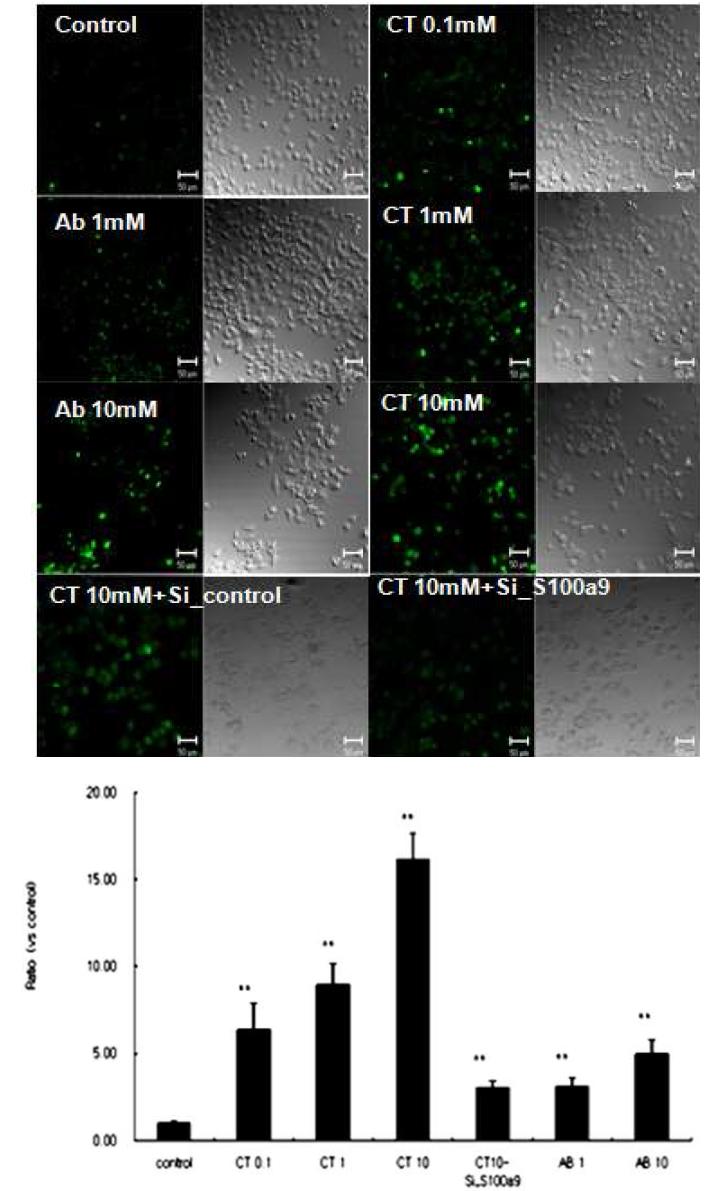 CT 또는 Aβ 단백질 처리후 siS100a9 처리에 따른 세포내 칼슘 level의 변화 확인