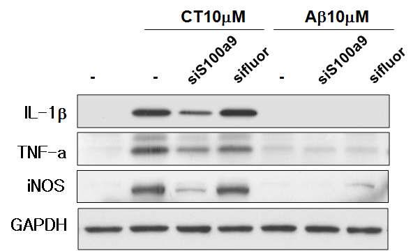 CT 또는 Aβ 단백질 처리후 siS100a9 처리에 땨른 면역관련 단백질들의 발현 변화 확인