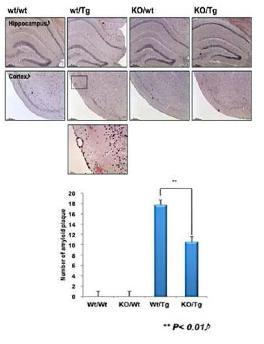 S100a9 KO과 Tg2576 교배 마우스에서 Amyloid Plaques의 비교 결과