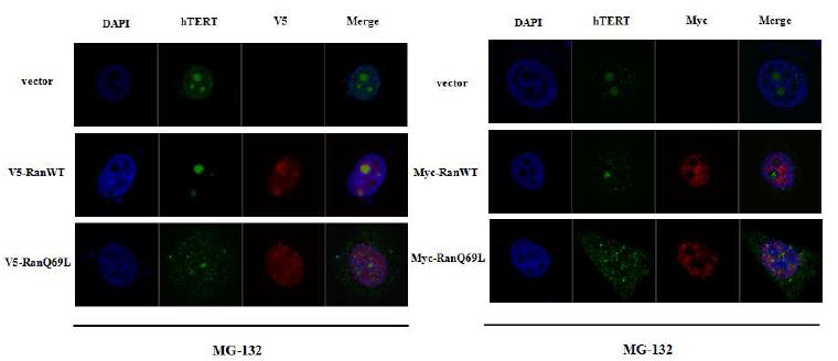 Figure 2. Immunofluorescence of co-localization of endogenous hTERT and Ran