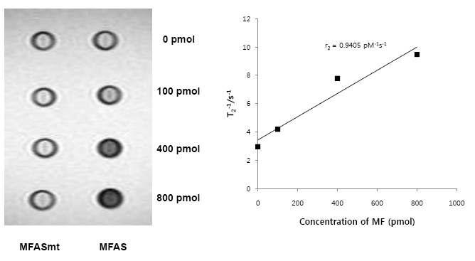 신경교종에서 MFAS 나노입자의 표적친화력 정량적 T2 weighted image 분석.