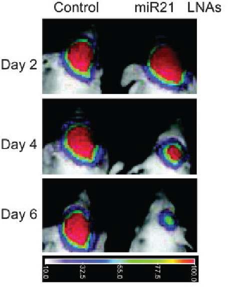 마이크로RNA-21 antagomir을 이용한 신경교종세포 치료 생체광학영상.