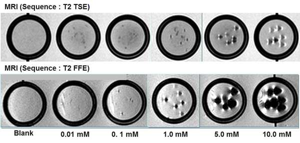 In vitro 팬텀 모델(phantom model)에서 다양한 농도의 SPIO 나노입자를 탑재한 키토산 미세구의 T2 강조영상 촬영 결과