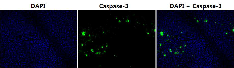 인체 간암 세포주 (SNU-398) 이식 종양모델에서 Caspase-3을 이용한 세포사멸 확인.