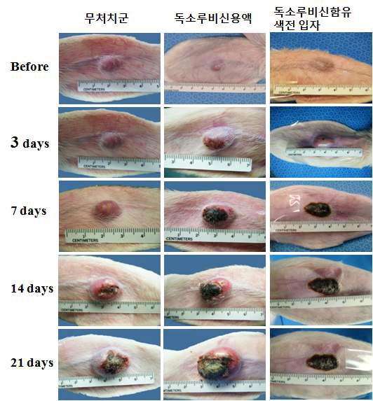 독소루비신 함유 키토산 미세구의 항암 활성