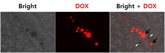 가토 VX2 귀암 조직에서 독소루비신 담지된 색전 미세구(→) 및 제제로부터 방출된 독소루비신의 조직 분포(▷)
