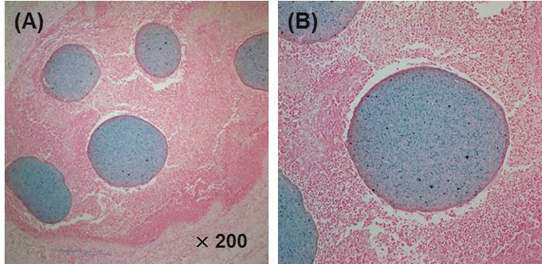 SPIO를 탑재한 키토산 미세구로 신동맥 색전술을 시행 후, 프러시안 블루로 염색한 조직의 이미지
