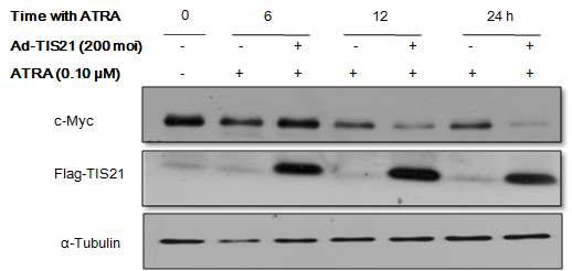 Effect of Ad-TIS21 and ATRA on c-myc expression in HL-60 cells.