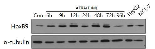 HoxB9 induction by ATRA treatment in HL-60 cells