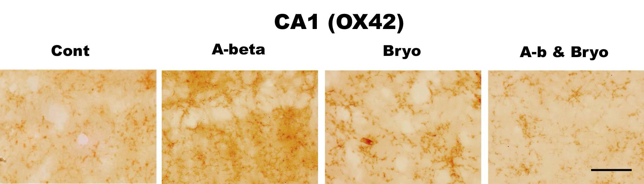 Effects of Bryostatin-1 on glial cell activation in CA1 hippocampus in rat. Bryostatin-1 significantly suppresses a microglia activation in CA1 of rat infused with amyloid beta. Intracerebro-ventricular infusion of Aβ and Bryostatin-1 was for four weeks using a micro-osmotic pump. Immuno- histochemistry (anti-CD11b) (scale bar, 50μm)(40Χ magnification)