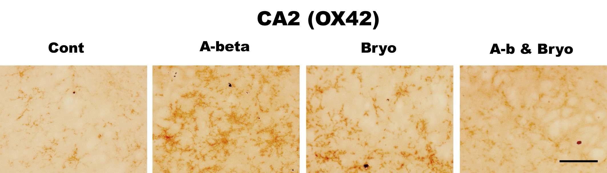 Effects of Bryostatin-1 on glial cell activation in CA2 hippocampus in rat. Bryostatin-1 significantly suppresses a microglia activation in CA2 of rat infused with amyloid beta. Intracerebro-ventricular infusion of Aβ and Bryostatin-1 was for four weeks using a micro-osmotic pump. Immuno- histochemistry (anti-CD11b) (scale bar, 50μm)(40Χ magnification)