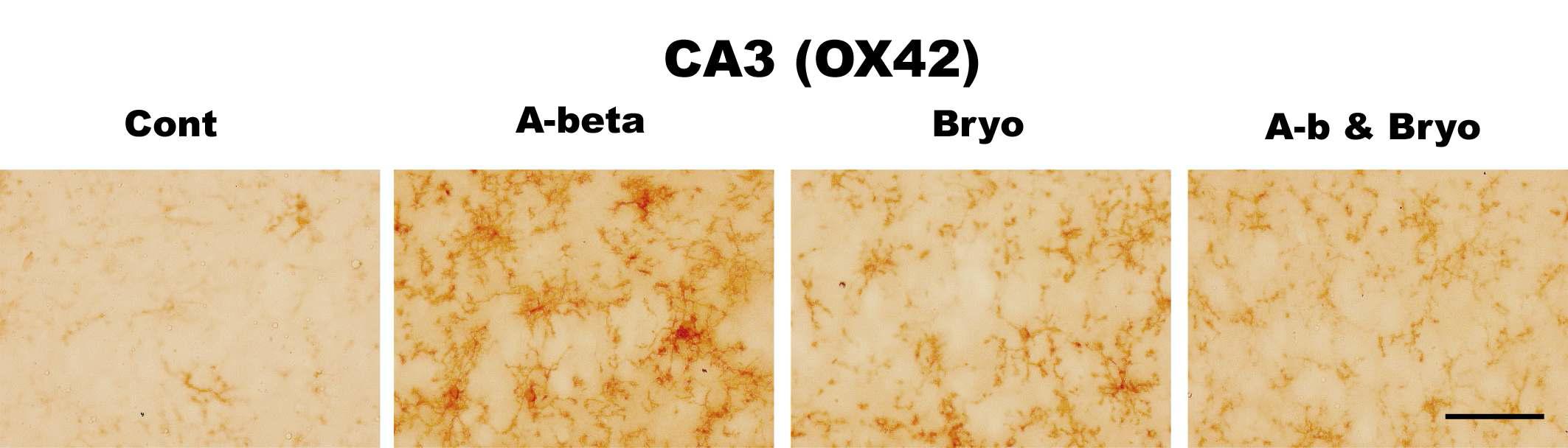 Effects of Bryostatin-1 on glial cell activation in CA3 hippocampus in rat. Bryostatin-1 significantly suppresses a microglia activation in CA3 of rat infused with amyloid beta. Intracerebro-ventricular infusion of Aβ and Bryostatin-1 was for four weeks using a micro-osmotic pump. Immuno- histochemistry (anti-CD11b) (scale bar, 50μm)(40Χ magnification)