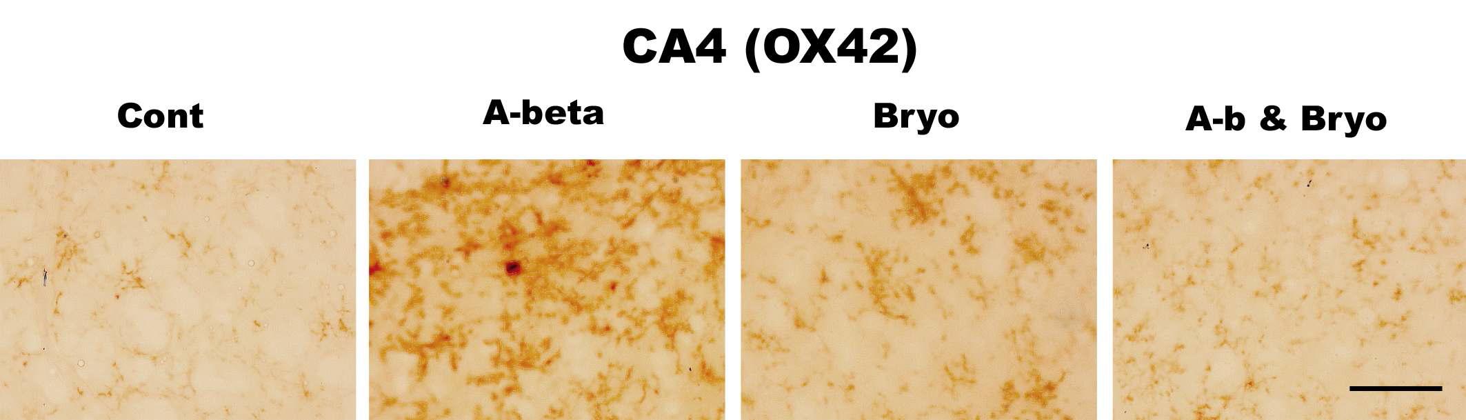 Effects of Bryostatin-1 on glial cell activation in CA4 hippocampus in rat. Bryostatin-1 significantly suppresses a microglia activation in CA4 of rat infused with amyloid beta. Intracerebro-ventricular infusion of Aβ and Bryostatin-1 was for four weeks using a micro-osmotic pump. Immuno- histochemistry (anti-CD11b) (scale bar, 50μm)(40Χ magnification)