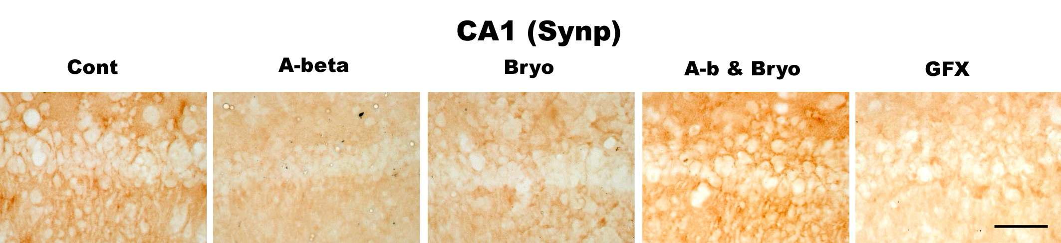Effects of Bryostatin-1 on synapses in CA1 pyramidal neurons of hippocampus in rat. Bryostatin-1 significantly prevented reduction of synaptophysin (presynaptic protein) in CA1 of rat infused with amyloid beta. PKC inhibitor GFX 109203 reduces synaptophysin in CA1. Intracerebro-ventricular infusion of Aβ and Bryostatin-1 was for four weeks using a micro-osmotic pump. PKC inhibitor GFX 109203 was administrated with I.c.v. injection. Immuno- histochemistry (anti-CD11b) (scale bar, 50μm)(40Χ magnification)