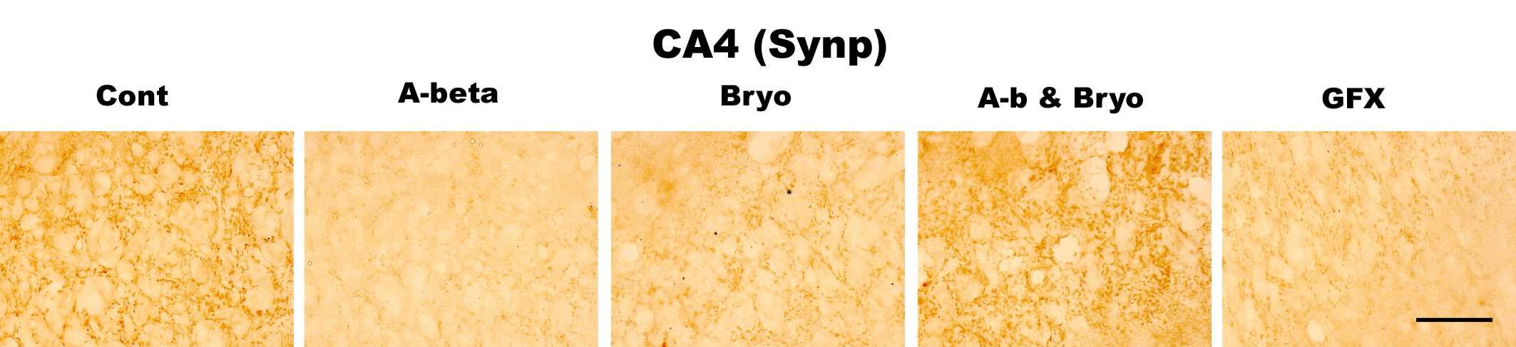 Effects of Bryostatin-1 on synapses in CA4 pyramidal neurons of hippocampus in rat. Bryostatin-1 significantly prevented reduction of synaptophysin (presynaptic protein) in CA4 of rat infused with amyloid beta. PKC inhibitor GFX 109203 reduces synaptophysin in CA4. Intracerebro-ventricular infusion of Aβ and Bryostatin-1 was for four weeks using a micro-osmotic pump. PKC inhibitor GFX 109203 was administrated with I.c.v. injection. Immuno- histochemistry (anti-CD11b) (scale bar, 50μm)(40Χ magnification)