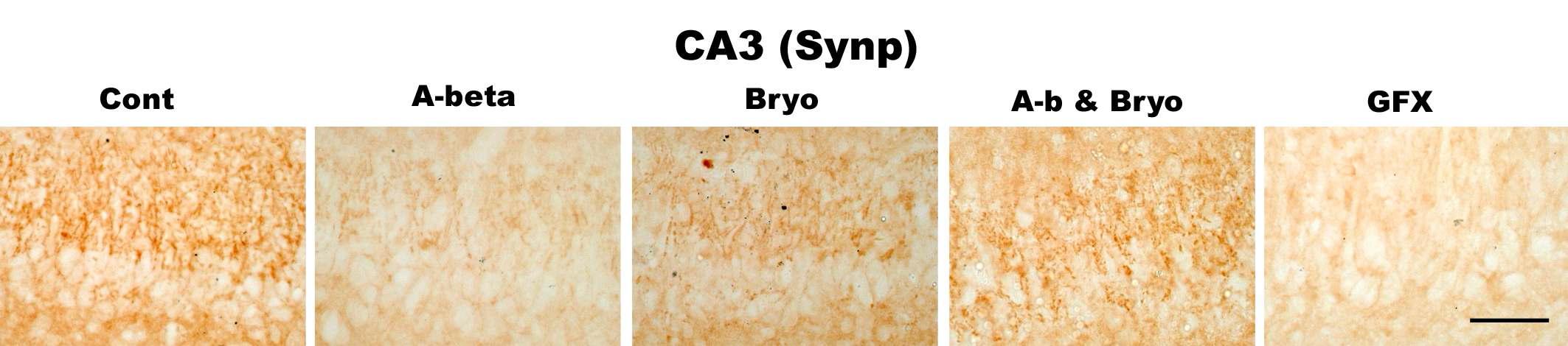 Effects of Bryostatin-1 on synapses in CA3 pyramidal neurons of hippocampus in rat. Bryostatin-1 significantly prevented reduction of synaptophysin (presynaptic protein) in CA3 of rat infused with amyloid beta. PKC inhibitor GFX 109203 reduces synaptophysin in CA3. Intracerebro-ventricular infusion of Aβ and Bryostatin-1 was for four weeks using a micro-osmotic pump. PKC inhibitor GFX 109203 was administrated with I.c.v. injection. Immuno- histochemistry (anti-CD11b) (scale bar, 50μm)(40Χ magnification)