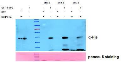 γ-VPE 단백질과 GLIP1 단백질의 in vitro binding assay