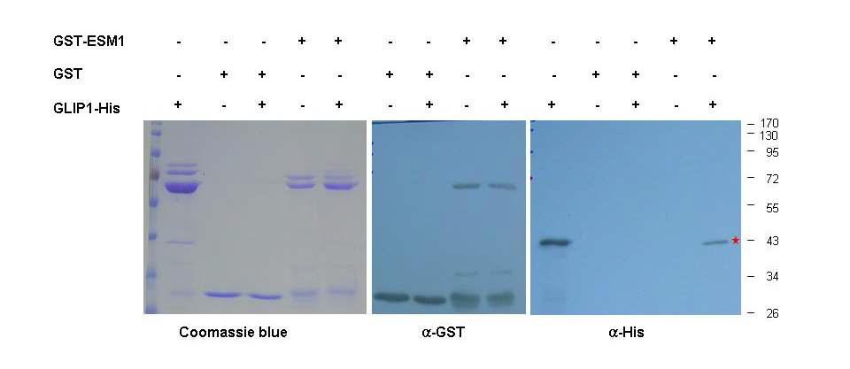 pull-down assay를 통한 ESM과 GLIP1의 in vitro interaction 확인