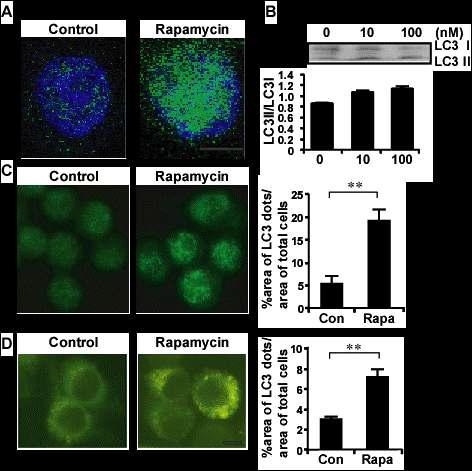 BV2 세포주에서 rapamycin 처리 후, autophagosme의 형성 유무 확인 실험 결과