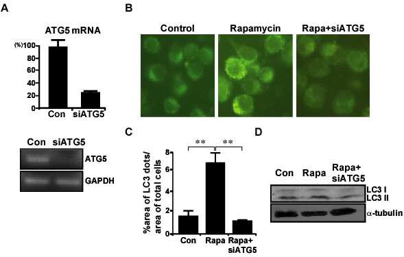 BV2 세포주에서 ATG5 siRNA 처리 후, rapamycin에 의한 autophagosome의 형성 유무 확인 실험 결과
