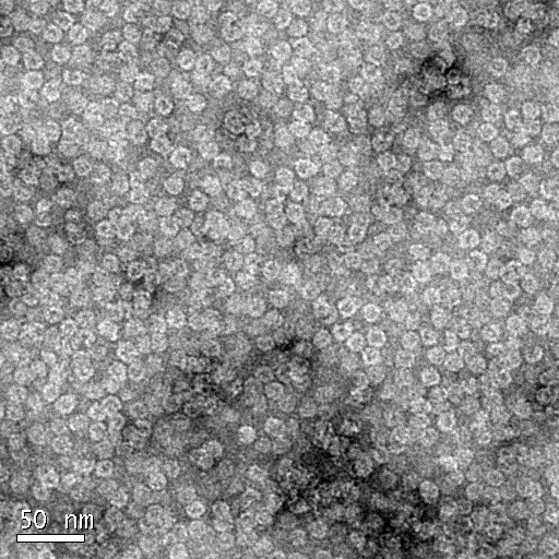 Aptamer(for IgE)가 접합된 FTH-H::Linker::eGFP의 TEM 이미지