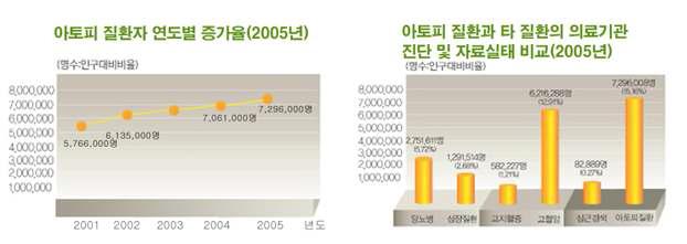 아토피 질환자 연도별 증가율(왼쪽)과 아토피 질환과 타 질환의 의료기관 진단 및 자료실태 비교(오른쪽).