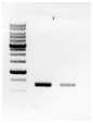 PCR products of SOCS-1 cDNA