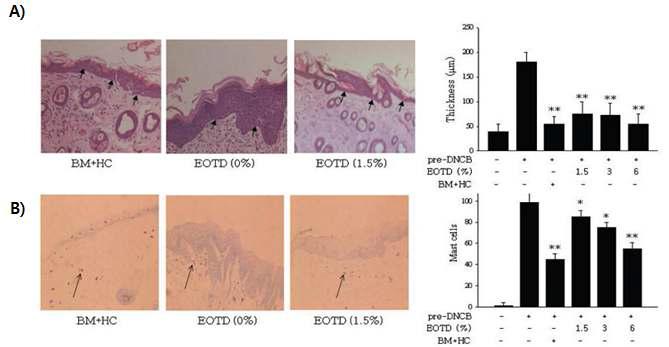 Effect of EOTD on tissue thickness and mast cell recruitment in NC/Nga mice.