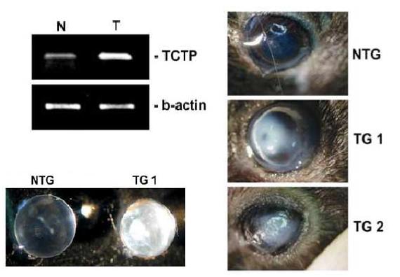 TCTP-TG 수정체에서 TCTP 과발현 및 백내장 발병 증가