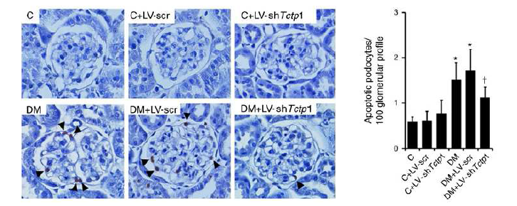 Lentivirus system을 이용하여 TCTP 저해시 사구체 족세포 사 멸 감소