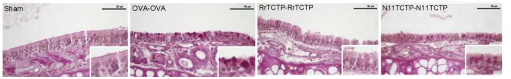 아미노기말단 절단형 TCTP가 이량체 형성으로 마우스의 폐조직 및 비강점막에서 염증을 유발함