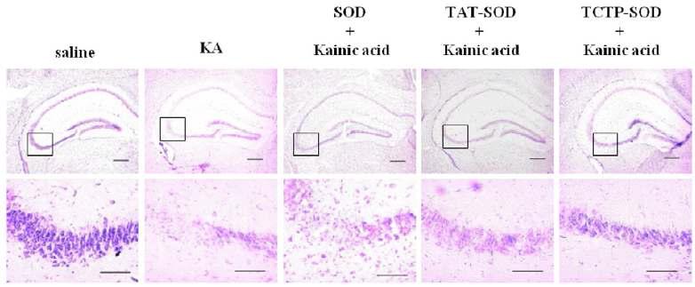 TCTP-PTD와 SOD 융합단백질은 KA로 인한 뇌손상을 감소시킴