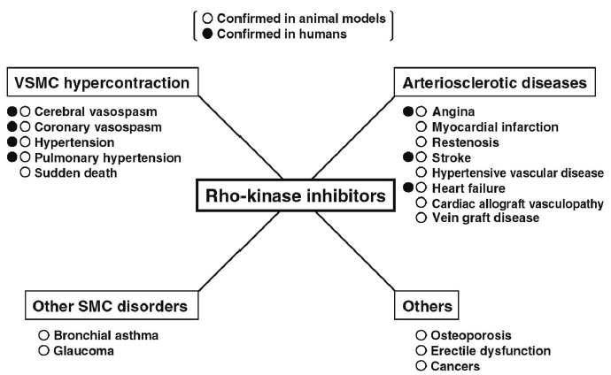 Rho kinase 저해제의 치료효과