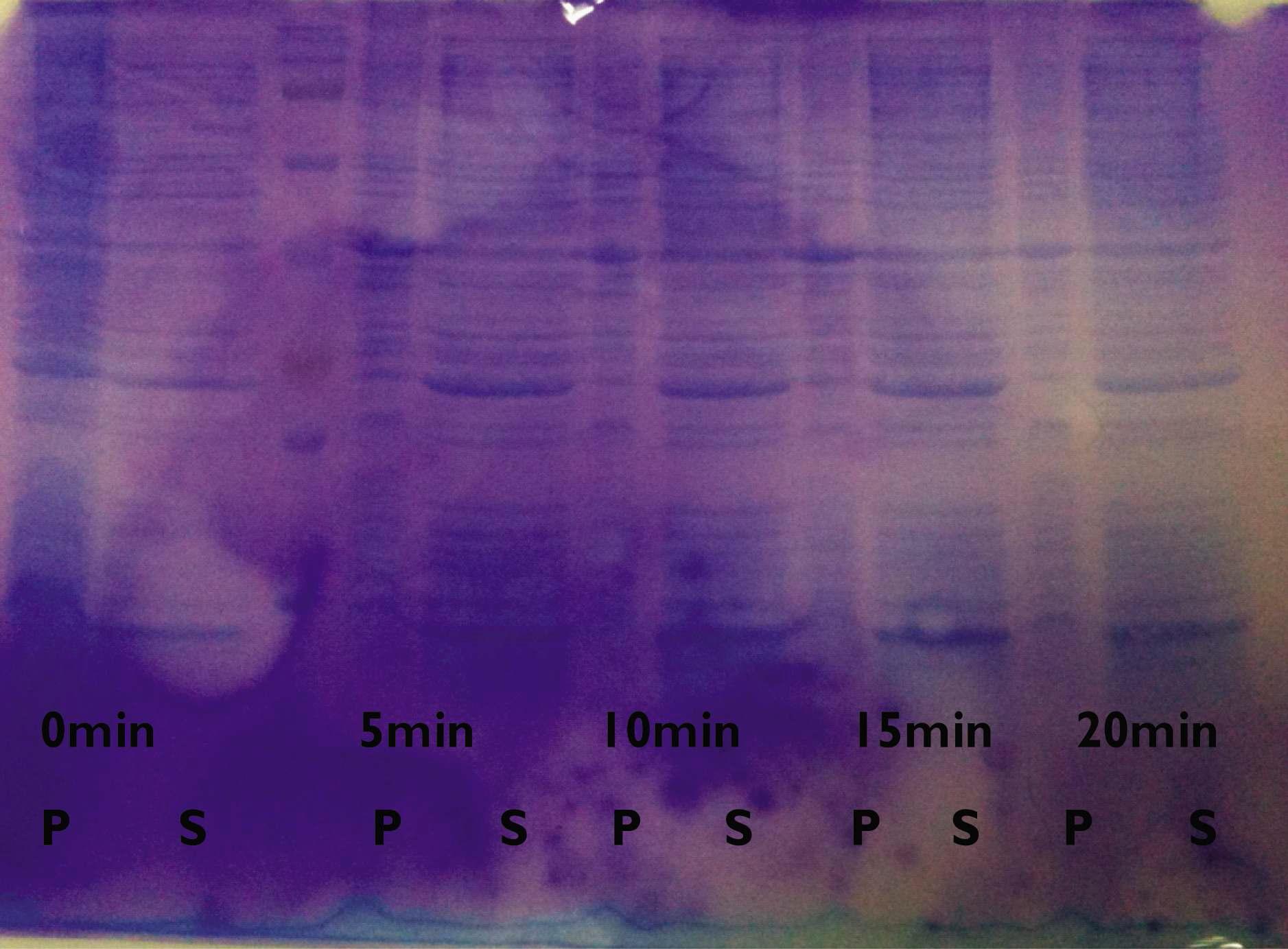 hFLNa24의 solubility test