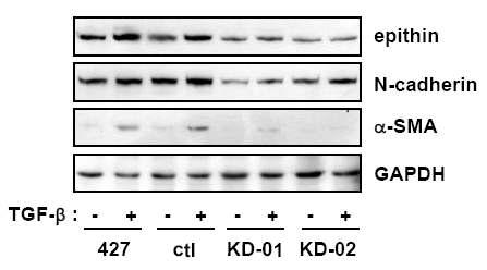 epithin knock-down 세포주에서 TGF-β에 의한 mesenchymal marker 발현이 억제됨