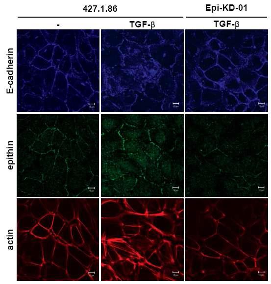 epithin knock-down 세포주에서 TGF-β에 의한 adherent junction 분해와 actin cytoskeleton 재배열이 억제됨