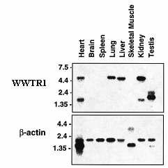다양한 성체 조직에서의 WWTR1 유전자의 발현 비교