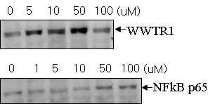 Bleomycin 처리에 따른 폐상피세포에서의 WWTR1 발현 및 NFkB p65 발현 변화