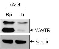 WWTR1의 발현을 감소시킨 A549 세포주 확립 Bp: control 세포주, Ti: WWTR1 감소세포주