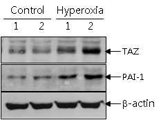 과산소 노출에 의한 폐조직내 PAI-1과 TAZ 단백질 발현 변화